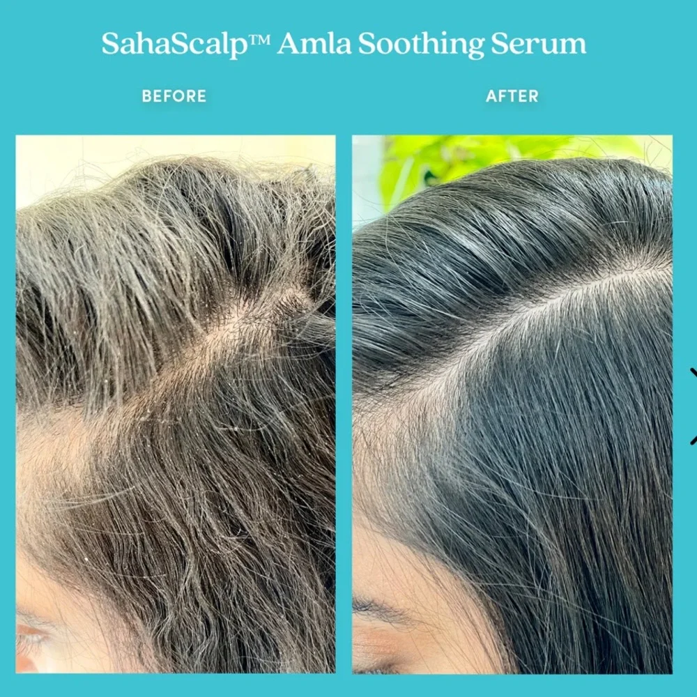Fable & Mane SahaScalp™ Amla Soothing Serum soothing pre-wash hair oil